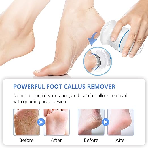 Electric Foot Grinder Tool